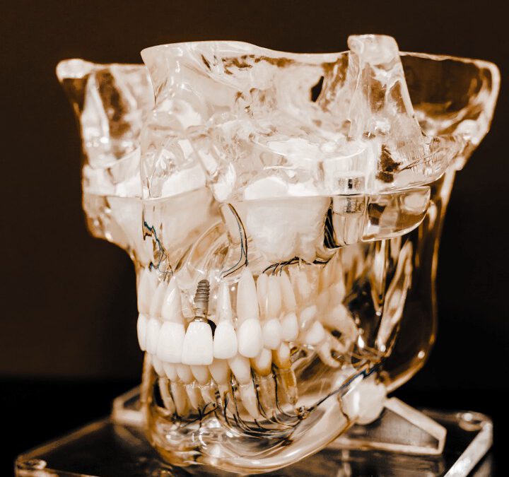 Störfelder im Kiefer und ihre Auswirkungen auf den Körper